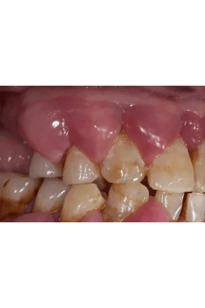 How Oralens app can help you?