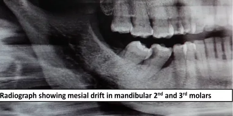 How Oralens app can help you?