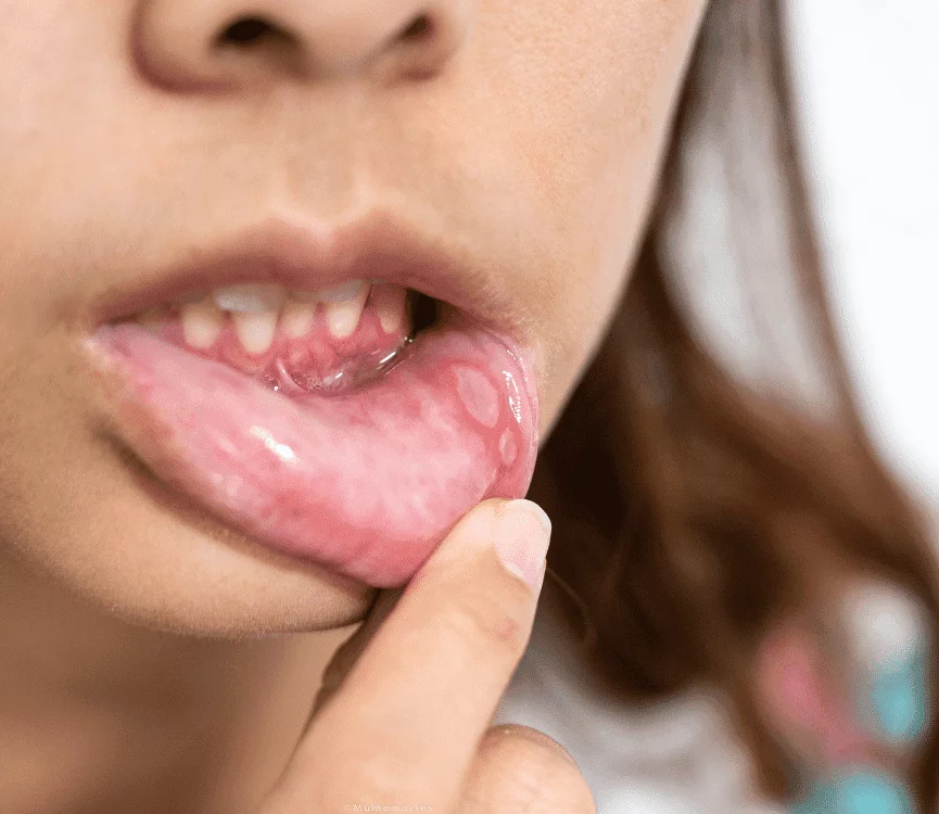 How Oralens app can help you?