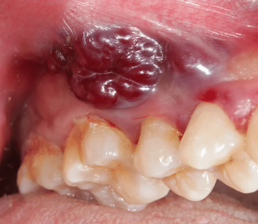 How Oralens app can help you?