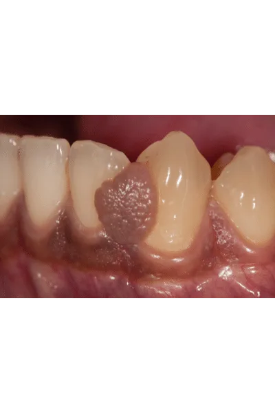 How Oralens app can help you?